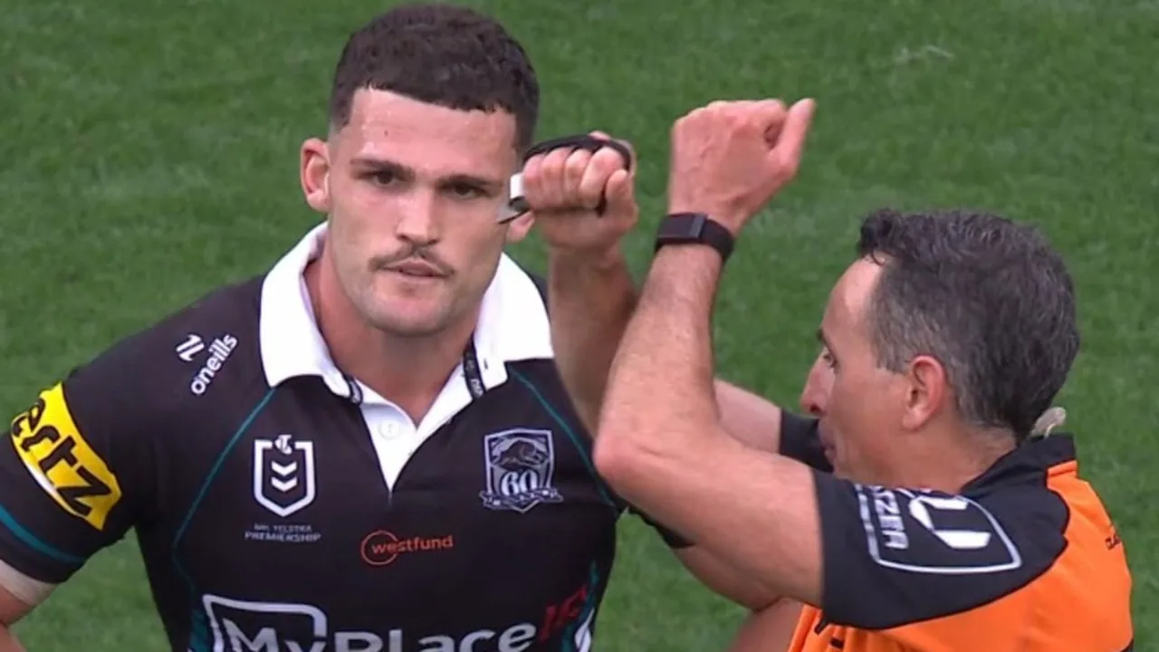 ‘Conceal the severity’: Panthers’ Cleary injury reveal questioned with worrying report - Fox Sports